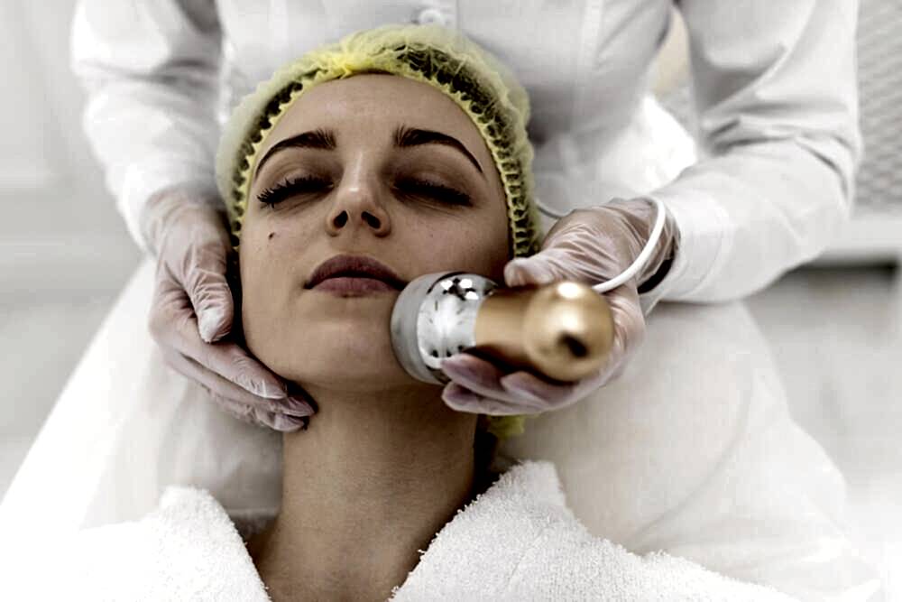 RF Лифтинг Лица